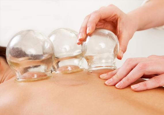 El masaje con ventosas consiste en aplicar ventosas sobre el cuerpo, a las que se les extrae el aire, y que se manipulan con el fin de eliminar toxinas de la sangre y la linfa, o tratar diversas afecciones físicas. 