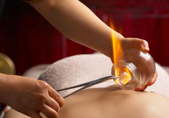 El masaje con ventosas consiste en aplicar ventosas sobre el cuerpo, a las que se les extrae el aire, y que se manipulan con el fin de eliminar toxinas de la sangre y la linfa, o tratar diversas afecciones físicas. 