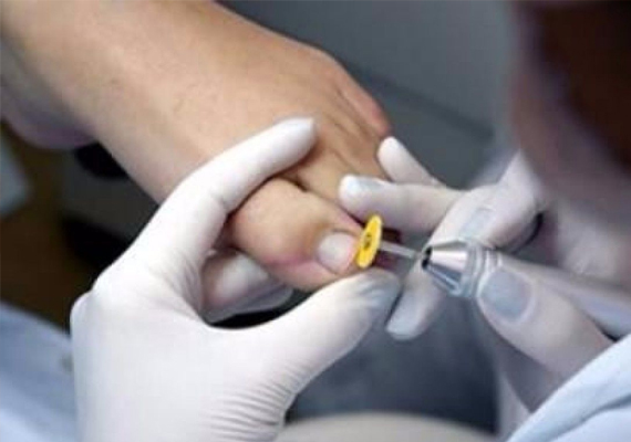 La pedicuría consiste en atender la higiene y las afecciones de los pies. Si cuidas tus pies veras que ellos te lo agradecerán luciendo bonitos y haciéndote sentir mejor. La pedicura no es solo cortar, limar y pintar las uñas de los pies. Esta especialidad engloba el cuidado integral de nuestros pies, sus uñas y las piernas.
