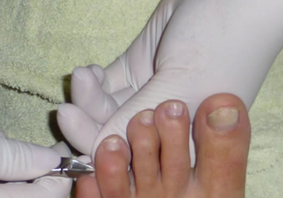 La pedicuría consiste en atender la higiene y las afecciones de los pies. Si cuidas tus pies veras que ellos te lo agradecerán luciendo bonitos y haciéndote sentir mejor. La pedicura no es solo cortar, limar y pintar las uñas de los pies. Esta especialidad engloba el cuidado integral de nuestros pies, sus uñas y las piernas.
